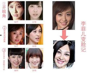 整形手术爆料视频大全下载,爆料视频大全深度解析